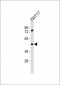 Endothelin A Receptor Antibody